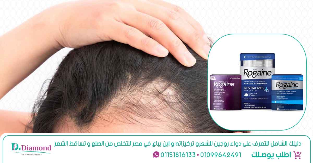 دليلك-الشامل-للتعرف-على-دواء-روجين-للشعرو-تركيزاته-و-اين-يباع-في-مصر-للتخلص-من-الصلع-و-تساقط-الشعر